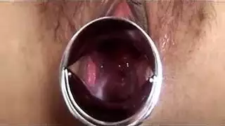 دواده شپه