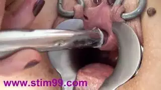 اختراق شرجي مزدوج بعد إزالة السدادة