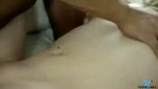 قرنية في سن المراهقة على وجهها